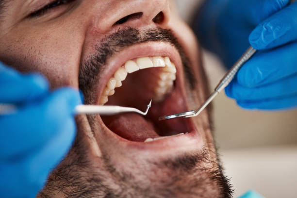 Best Dental Abscess Treatment in West Des Moines, IA